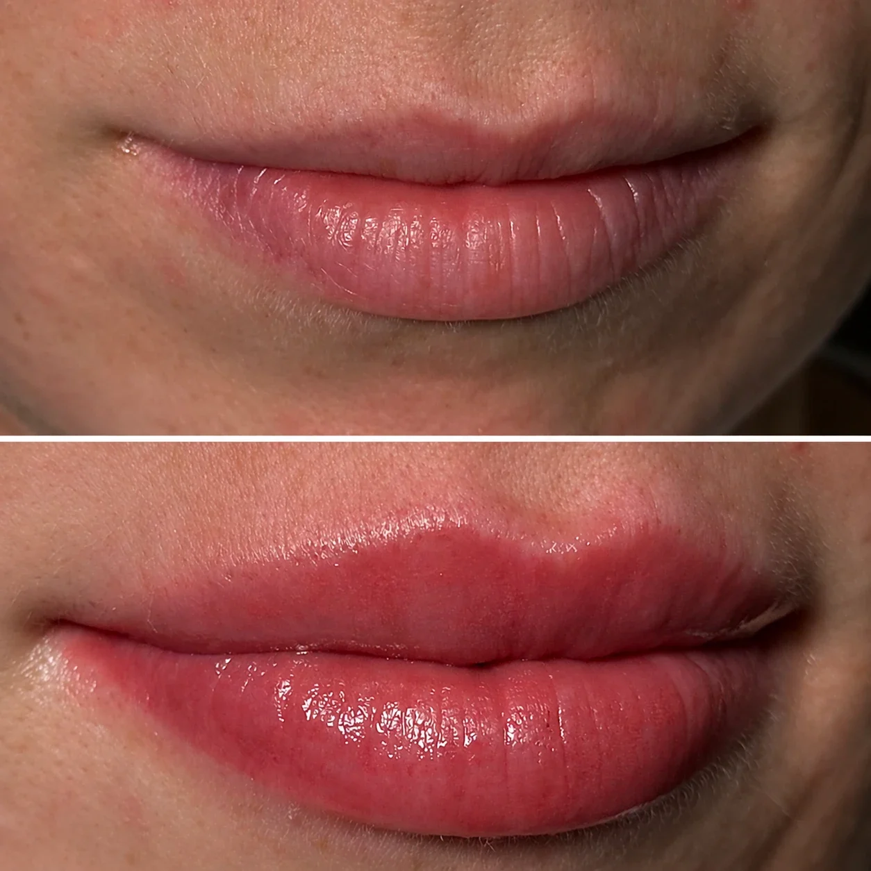 Vorher-Nachher-Ergebnis einer Lip-Blush-Behandlung